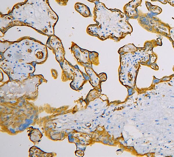 GLUT1 Antibody in Immunohistochemistry (Paraffin) (IHC (P))