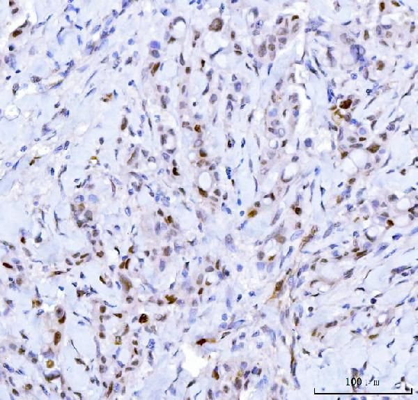 CDK2 Antibody in Immunohistochemistry (Paraffin) (IHC (P))