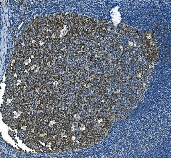 MCM2 Antibody in Immunohistochemistry (Paraffin) (IHC (P))