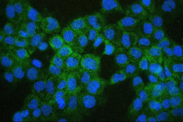 COMT Antibody in Immunocytochemistry (ICC/IF)