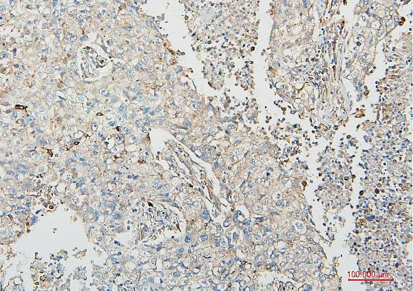 COMT Antibody in Immunohistochemistry (Paraffin) (IHC (P))