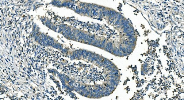 IDH2 Antibody in Immunohistochemistry (Paraffin) (IHC (P))