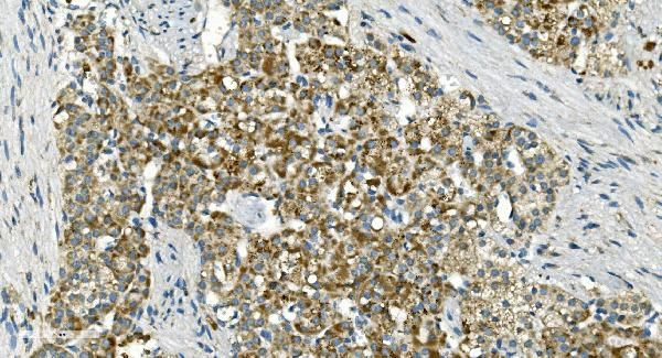 IDH2 Antibody in Immunohistochemistry (Paraffin) (IHC (P))