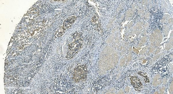 IDH2 Antibody in Immunohistochemistry (Paraffin) (IHC (P))