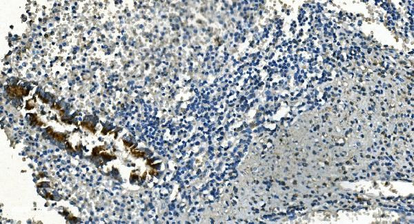 IDH2 Antibody in Immunohistochemistry (Paraffin) (IHC (P))