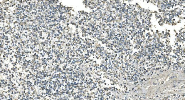 IDH2 Antibody in Immunohistochemistry (Paraffin) (IHC (P))