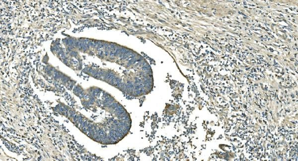 IDH2 Antibody in Immunohistochemistry (Paraffin) (IHC (P))