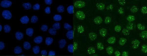 XRCC1 Antibody in Immunocytochemistry (ICC/IF)