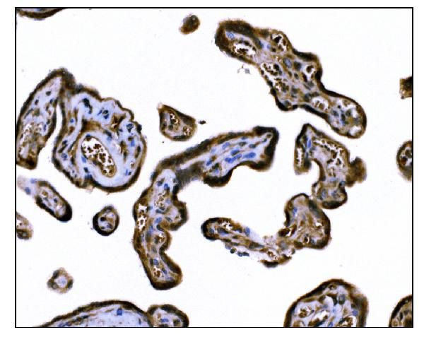 TGFBR2 Antibody in Immunohistochemistry (Paraffin) (IHC (P))