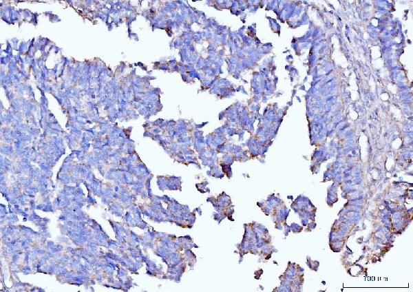 Moesin Antibody in Immunohistochemistry (Paraffin) (IHC (P))