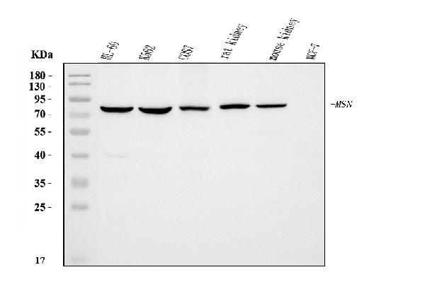 Moesin Antibody in Western Blot (WB)