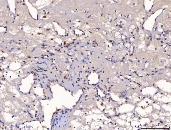 YY1 Antibody in Immunohistochemistry (Paraffin) (IHC (P))