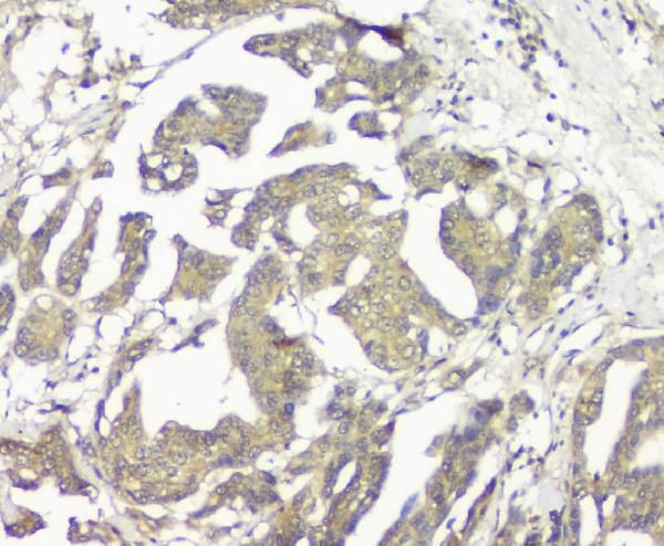 GNAQ Antibody in Immunohistochemistry (Paraffin) (IHC (P))