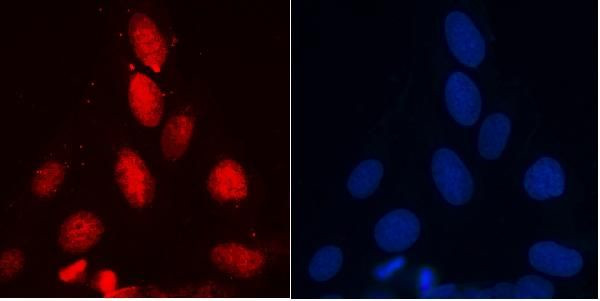 UPF1 Antibody in Immunocytochemistry (ICC/IF)