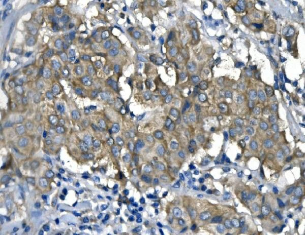 UPF1 Antibody in Immunohistochemistry (Paraffin) (IHC (P))