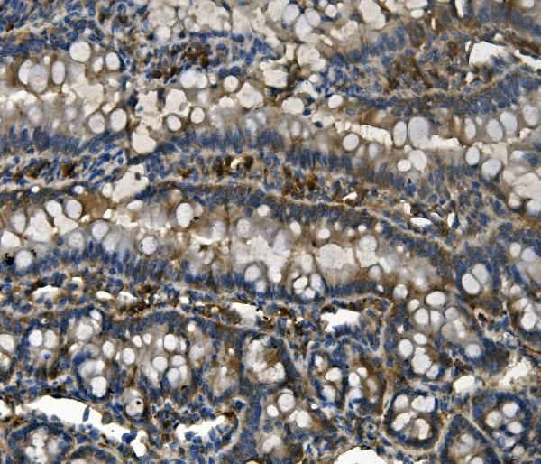 UPF1 Antibody in Immunohistochemistry (Paraffin) (IHC (P))