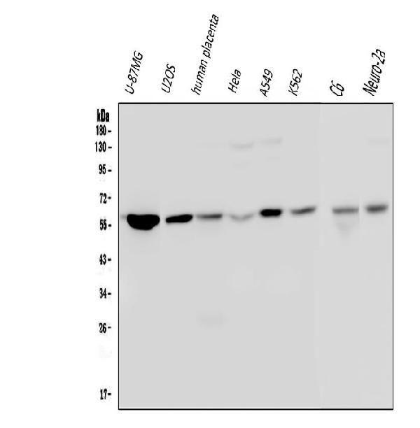 Optineurin Antibody in Western Blot (WB)