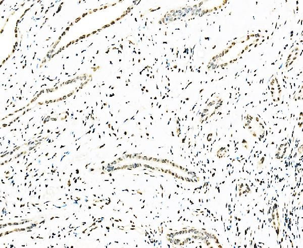 SF1 Antibody in Immunohistochemistry (Paraffin) (IHC (P))