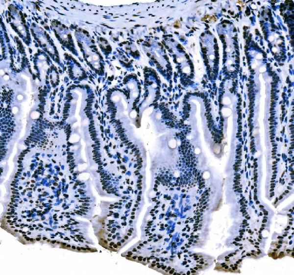 SF1 Antibody in Immunohistochemistry (Paraffin) (IHC (P))