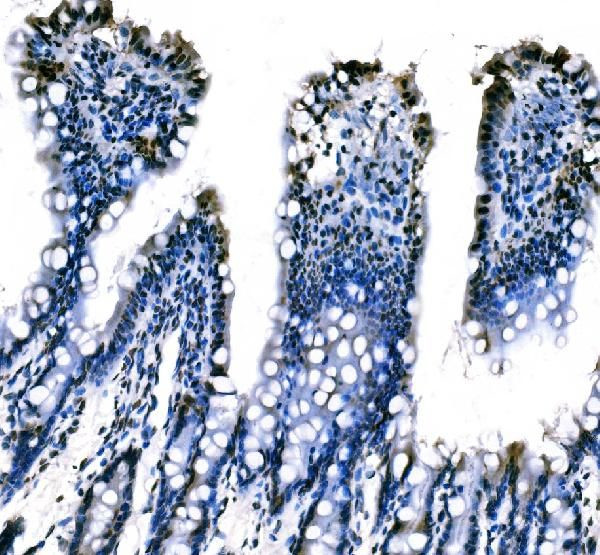 SF1 Antibody in Immunohistochemistry (Paraffin) (IHC (P))