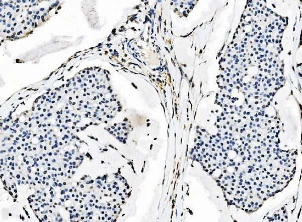 SF1 Antibody in Immunohistochemistry (Paraffin) (IHC (P))