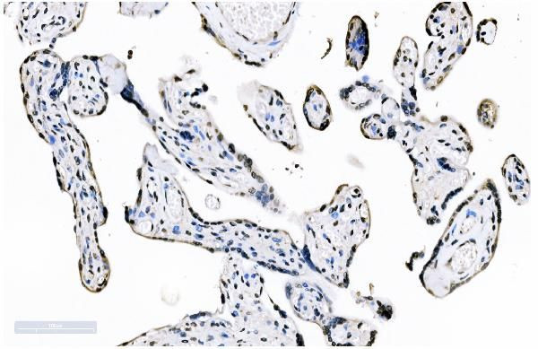 SF1 Antibody in Immunohistochemistry (Paraffin) (IHC (P))