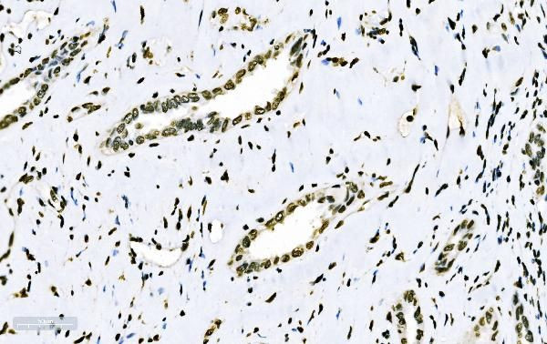 SF1 Antibody in Immunohistochemistry (Paraffin) (IHC (P))