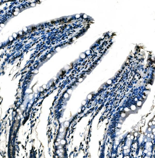 SF1 Antibody in Immunohistochemistry (Paraffin) (IHC (P))