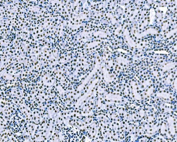 SF1 Antibody in Immunohistochemistry (Paraffin) (IHC (P))