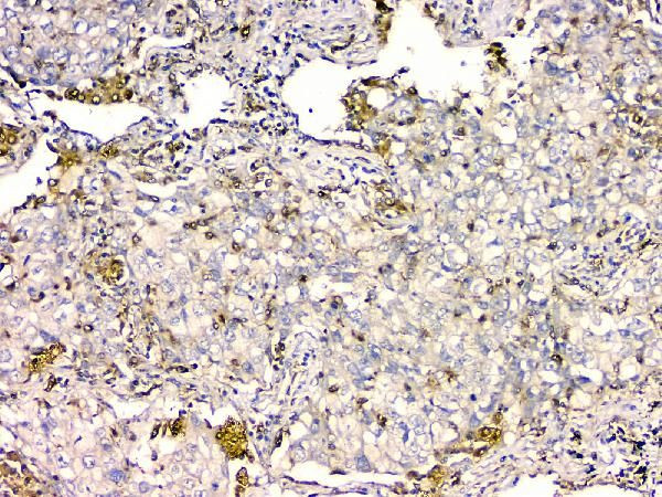 GPX1 Antibody in Immunohistochemistry (Paraffin) (IHC (P))