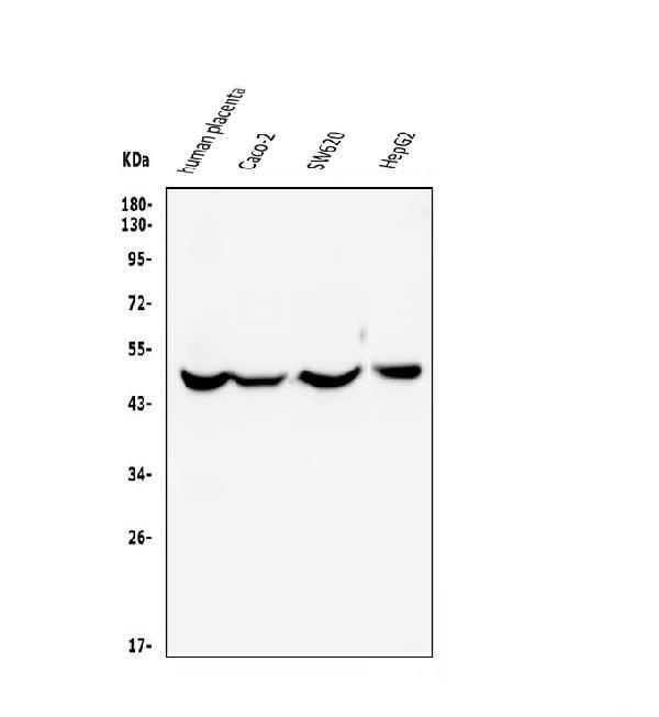 Endothelin B Receptor Antibody in Western Blot (WB)