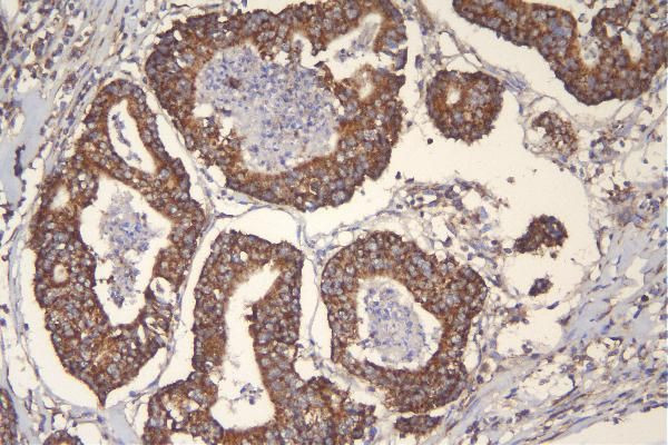 TFAM Antibody in Immunohistochemistry (Paraffin) (IHC (P))