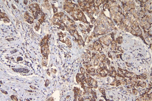 TFAM Antibody in Immunohistochemistry (Paraffin) (IHC (P))