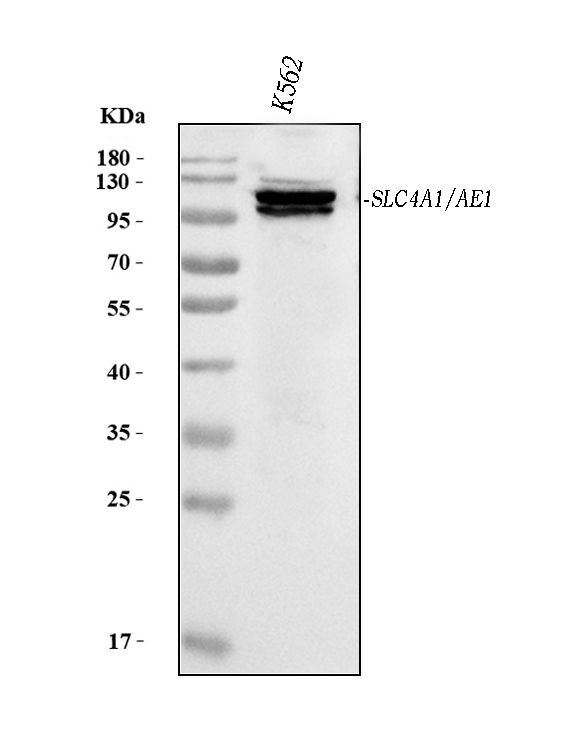 Band 3 Antibody in Western Blot (WB)