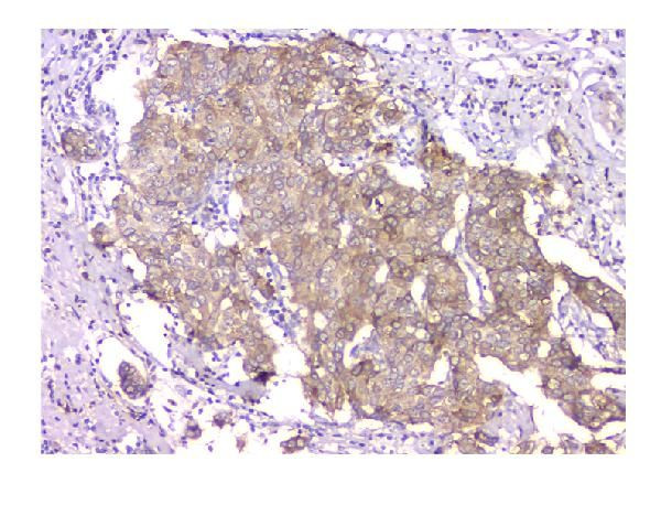 WWOX Antibody in Immunohistochemistry (Paraffin) (IHC (P))