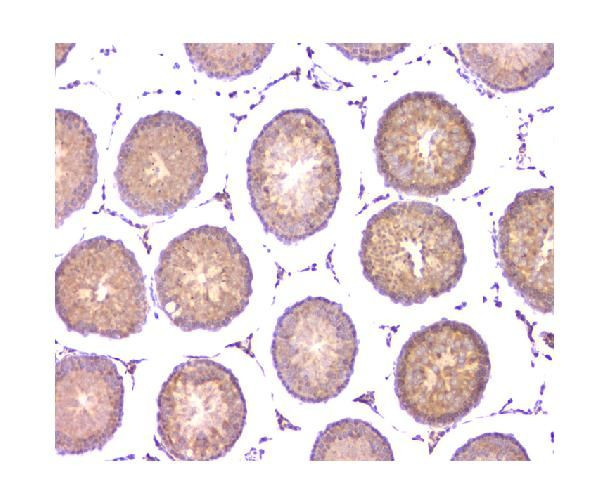 WWOX Antibody in Immunohistochemistry (Paraffin) (IHC (P))