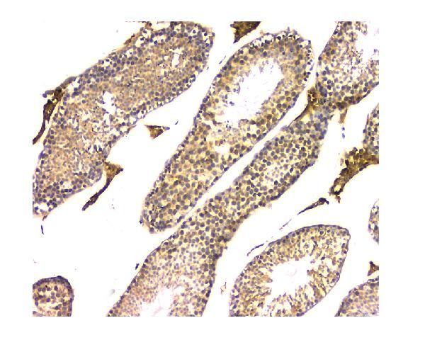 WWOX Antibody in Immunohistochemistry (Paraffin) (IHC (P))