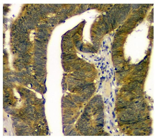 STUB1 Antibody in Immunohistochemistry (Paraffin) (IHC (P))