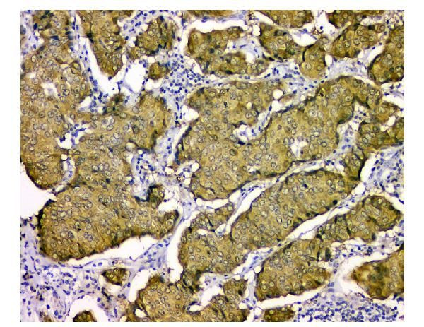 STUB1 Antibody in Immunohistochemistry (Paraffin) (IHC (P))