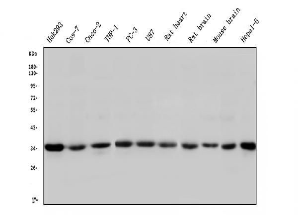 STUB1 Antibody in Western Blot (WB)