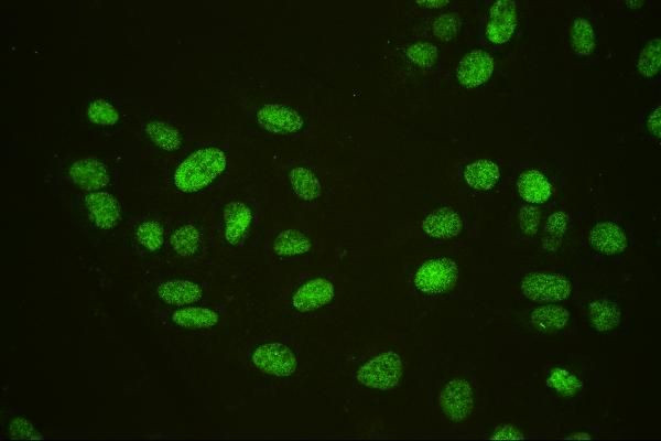 USP7 Antibody in Immunocytochemistry (ICC/IF)