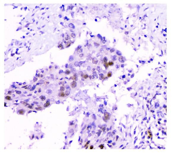 USP7 Antibody in Immunohistochemistry (Paraffin) (IHC (P))