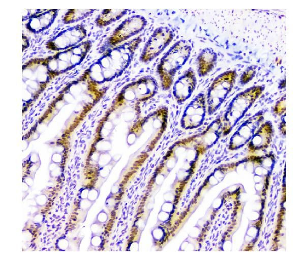 USP7 Antibody in Immunohistochemistry (Paraffin) (IHC (P))