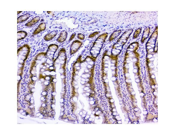 USP7 Antibody in Immunohistochemistry (Paraffin) (IHC (P))