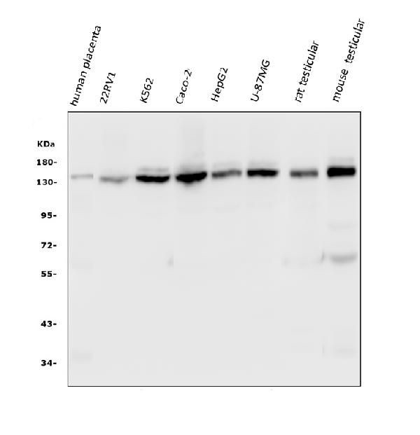 USP7 Antibody in Western Blot (WB)