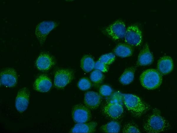 Glutaminase Antibody in Immunocytochemistry (ICC/IF)