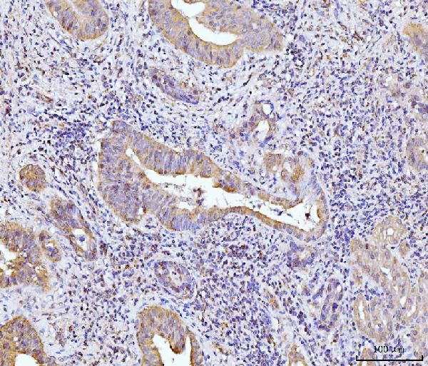 Glutaminase Antibody in Immunohistochemistry (Paraffin) (IHC (P))