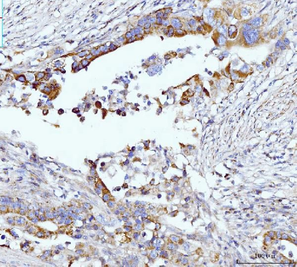 Glutaminase Antibody in Immunohistochemistry (Paraffin) (IHC (P))