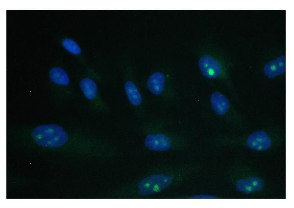 PARN Antibody in Immunocytochemistry (ICC/IF)