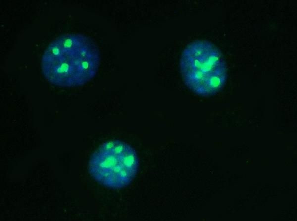 PARN Antibody in Immunocytochemistry (ICC/IF)